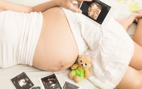 My 3D Baby Ultrasound Experience